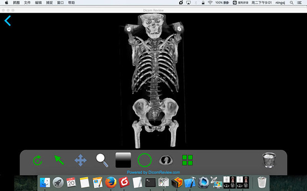 DicomReview截图