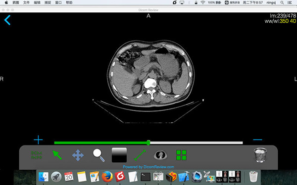 DicomReview截图