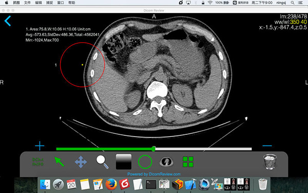 DicomReview截图