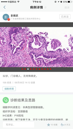 爱病理截图
